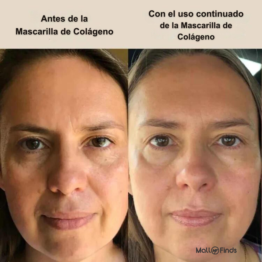 Mascarilla de biocolágeno Beacure®