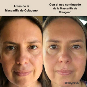 Mascarilla de biocolágeno Beacure®