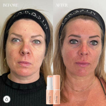 AgeReset Anti-Age RimpelStick